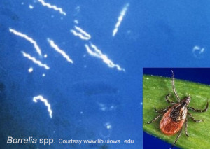 borrelia spp carrapato lyme