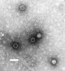 polio virus