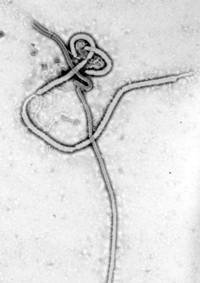 Vírus Ébola do Zaire