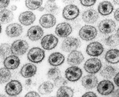 hiv-virus-microscope