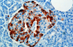 330px-Glucagon_rednblue