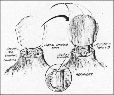 head-transplant-rhesus