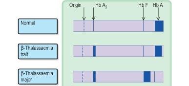 Eletroforese da hemoglobina. Imagem retirada de Medical Labs - Medical Laboratories Online.