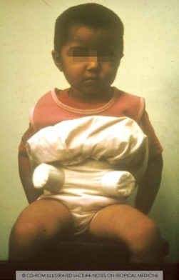 Boxes with non-infected Dipetalogaster maxima or Triatoma infestans, used in xenodiagnosis of Chagas' disease. Copyright ITM