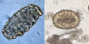 Ovo não fertilizado (esquerda) e ovos com embrião (direita) de A. lumbricoides. Imagens de CDC.