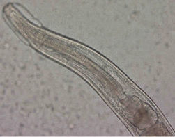 evermicularis_adult_anterior_norway