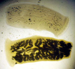 Proglótido adulto de T. saginata com tinta da China.