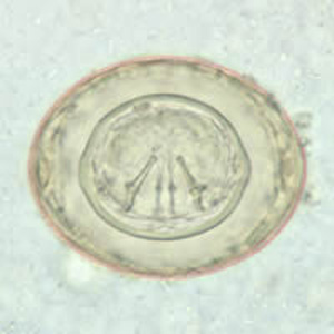 Ovo de H. diminuta