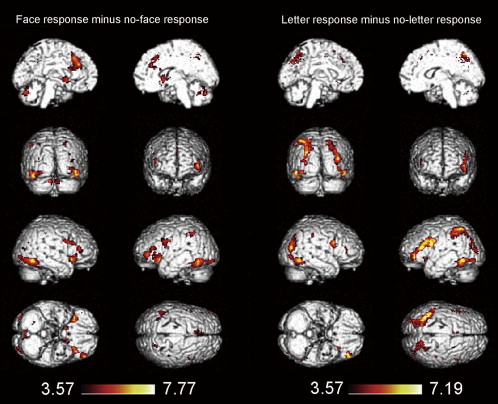 Actividade cerebral em resposta à observação das imagens